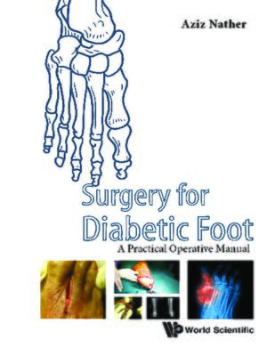 cover image of Surgery For Diabetic Foot